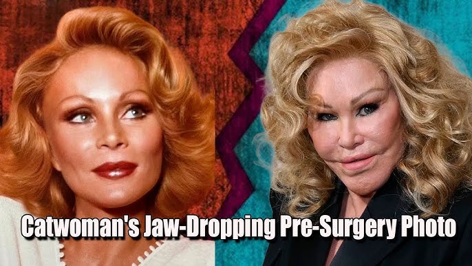 ‘Catwoman’ Jocelyn Wildenstein Shows Her Natural Visage In A Stunning Throwback Shot